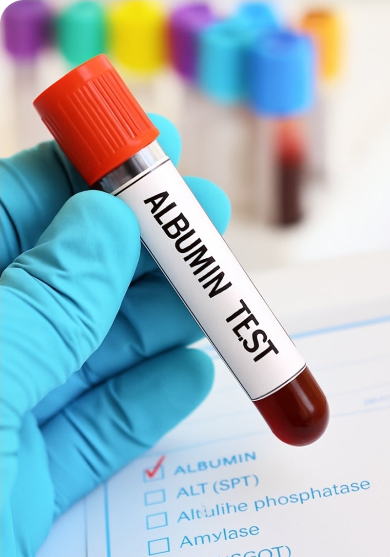 알부민 효능 및 먹능법 제대로 알고 드세요