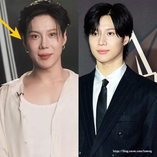 샤이니 태민 몰라보게 바뀐 얼굴 근황, 코 성형 논란에 본인 입장 밝혀